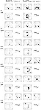 All the pc games to watch out for during 2019 and beyond listed by month. Spm Results In Glass Brain Projection Spm Glass Brains For Different Download Scientific Diagram