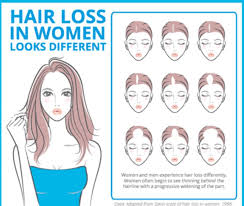You may notice that your combing directions. Garde Bien First Signs Of Hair Thinning Can Be A Facebook