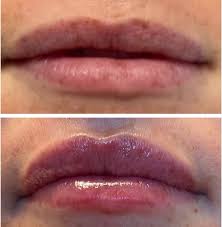 Lucy peters is home to the hair removal experts, physicians, and experienced technicians revolutionizing the industry of body hair removal, aesthetic . Lucy Peters Aesthetic Center Home Facebook