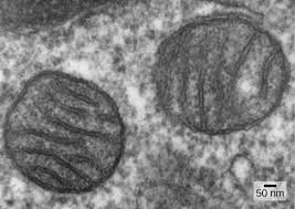 Is elodea eukaryotic or prokaryotic. Prokaryotes And Eukaryotes Biology For Non Majors I