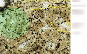 Compact bone, also called cortical bone, dense bone in which the bony matrix is solidly filled with organic ground substance and inorganic salts, leaving only tiny spaces (lacunae) that contain the osteocytes, or bone cells.compact bone makes up 80 percent of the human skeleton; Compact Bone Under Microscope Diagram Quizlet