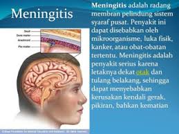 Pemerintah saudi awalnya hanya mengenakan yang terakhir adalah, kerajaan saudi arabia berencana untuk menaikkan pajak atas atas layanan umroh. Lokasi Suntik Vaksin Meningitis Di Lhokseumawe Aceh Kkp Lhokseumawe
