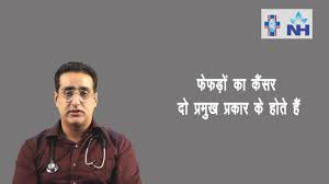 Talking about statistics of lung cancer in india, each year approximately 90,000 men & 80,000 women are diagnosed with cancer of lung & bronchi. Lung Cancer Symptoms Stages And Diagnosis Dr Raajit Chanana Hindi Youtube