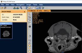Prosurgical dicom viewer can also anonymize patient data, so it is also useful for researchers. 16 Best Free Dicom Viewer Software For Windows