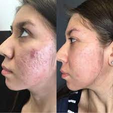 See bbb rating, reviews, complaints, & more. Hi Beautiful Aesthetics Medical Spas 9950 Westpark Dr Houston Tx Phone Number Yelp