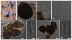 Image result for Colletoecema