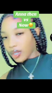 Anna Donato Before and After