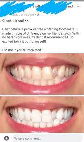 Check spelling or type a new query. Does Hydrogen Peroxide Whiten Teeth Reddit Teethwalls