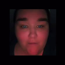 Becky Jones Lymedemia