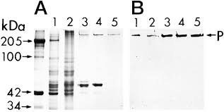 There are usually 1 to 3 discount codes for one product. Molecular Characteristics Of The Novel Intermediate Filament Protein Paranemin Journal Of Biological Chemistry