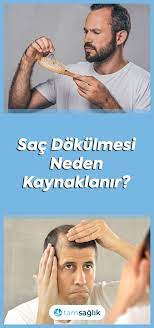 Sac Dokulmesi Neden Kaynaklanir Sac Dokulmesi Sac Saglik