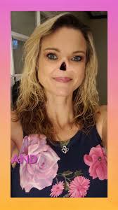 "Nothing is more beautiful than alive" ❤️ #fbreels #shakemybeauty  #nasalcancer #cancersurvivor #facialdifference #selfacceptance