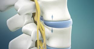 L4 L5 Lumbar Disc Herniation Icd 10 Manhattan Wellness Family Chiropractor Near Me Acupuncture Near Me Lower Back Pain Neck Pain Shoulder Pain Knee Pain Sciatica Pain Pinched Nerve Herniated Disc Back