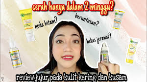 Review Garnier Light Complete Whitespeed Serum Bye Kulit Kering Kusam Dan Berjerawat Youtube