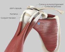 The conjoint tendon (previously known as the inguinal aponeurotic falx) is a sheath of connective tissue formed from the lower part of the common aponeurosis of the abdominal internal oblique muscle and the transversus abdominis muscle, joining the muscle to the pelvis. Coracoid Block Latarjet Procedure Doctor Matthieu Meyer