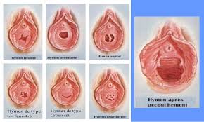 Hymen Comment Savoir Forum Sexualite Journal Des Femmes