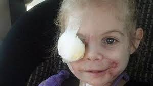 KFC 'hoax' girl arrives for surgery