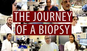 The tissue is generally examined under a microscope by a pathologist; What Is A Biopsy
