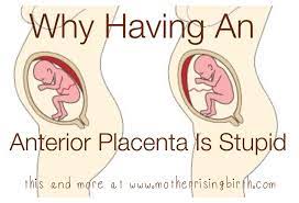 Pin On Pregnancy Birth Breastfeeding
