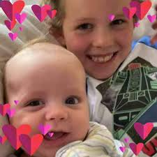 Well guys I had my legs crushed back in September from knees down in the  compactor of trash truck. By the grace of God I came out with 6 fractures a  partially