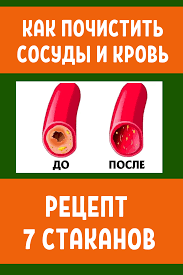 как очистить кровь в домашних условиях за один день Kak Pochistit Krov V Domashnih Usloviyah Health And Beauty Health And Beauty Tips Health Diet