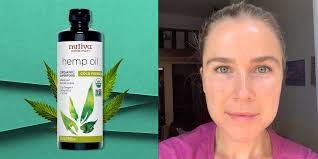 Also, you can use black seeds for healing diarrhea, constipation, gas, hemorrhoids, flu, bronchitis, cough, allergies, asthma, high blood pressure, menstruation, high cholesterol, etc. Hemp Seed Oil Benefits For Skin Hemp Seed Oil For Acne