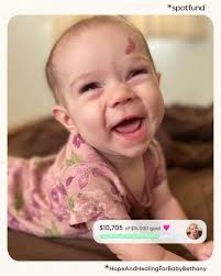 spotfund (@spotfund)