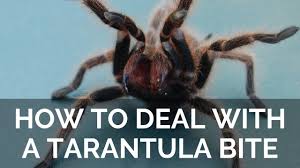 Image result for Tarantula Bite