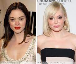 Mcgowan immediately replied to the user, writing, @katrinabunny coming from, ummm, you. the actress, who got reconstructive surgery after . Rose Mcgowan Plastic Surgery Before After Rose Mcgowan Plastic Surgery Celebrity Plastic Surgery Plastic Surgery