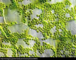 Overview by electron second, microscopy itself has seen remarkable advances. Plant Cells With Chloroplasts Microscopic Stock Photo 2406551 Panthermedia Stock Agency