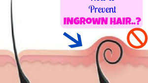 'ingrown hairs are caused when a growing hair gets trapped below the surface of the skin,' says robin parker, technical director at beauty innovators and so here are some other ways to help prevent ingrown hairs from ruining your day. How To Prevent Ingrown Hair Best Tips And Tricks Beauty Fashion Lifestyle Blog Beauty Fashion Lifestyle Blog