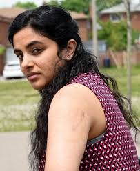 Etobicoke woman attacked by off-leash dog calls for tougher measures after  disappointing city response