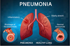 Pin On Medicine
