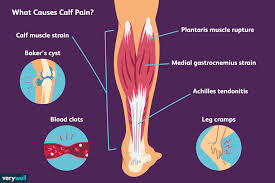 Pin On Aches Pains Sprains Strains