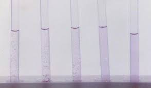 We did not find results for: Positive Widal Test For Anti H Antibodies Download Scientific Diagram