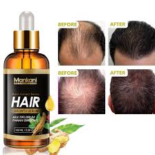 There are limited studies to support their effectiveness in treating hair loss, but a 2016 review. Mankani Hair Growth Oil Private Label Dense Hair Regrowth Essence Treatment Anti Hair Loss China Hair Loss Serum And Hair Loss Treatment Price Made In China Com