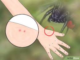 Maybe you would like to learn more about one of these? How To Identify A Spider Bite 7 Steps With Pictures Wikihow