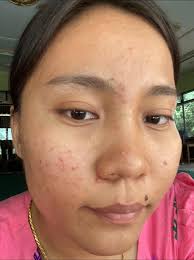 IAura Gel&Suncreen Yangon