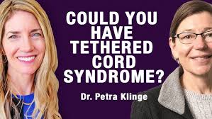 Histopathology of Occult Tethered Cord in Ehlers-Danlos Syndrome"