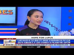 Bannatyne ga, wohlmann as, blaxall fr. Alamin Mga Sintomas Ng Lupus Bakit Ito Mahirap Matukoy Youtube