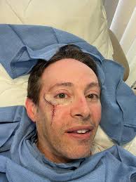 Life's fun expected delays! Good news is they got all the cancer out. I'm  telling everyone I fought off the criminal saving countless lives.