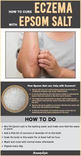 Use a gentle cleanser (no soaps) and avoid scrubbing the affected skin. How To Use Epsom Salt For Eczema Psoriasis Remedies Psoriasis Cure Eczema Remedies