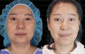 iOne Beverly Hills Plastic Surgery