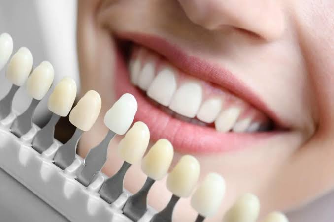 3 dental procedures that will improve your smile