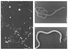 Myths, truths, and practical solutions for chronic lyme disease Spheroplasting Culture Of Borrelia Burgdorferi Cultivated From A Lyme Download Scientific Diagram