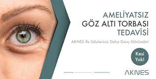 Goz Alti Torbasi Ameliyatsiz Tedavisi Gozler