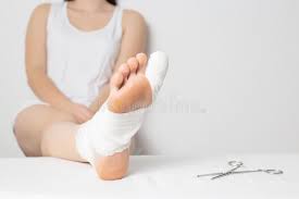Toes are the most commonly broken bones. Girl Patient In A Hospital With A Broken Big Toe Toe Injury Concept Sprain And Bruise Copy Space Stock Image Image Of Copy Injury 172102975