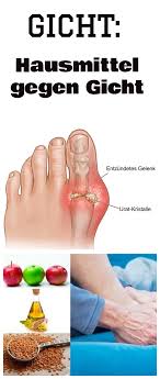 Mit den richtigen tees können sie eine behandlung ideal unterstützen und beschleunigen. Hausmittel Gegen Gicht Gout Remedies Home Remedies For Gout Gout Help