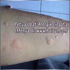 Buat pengetahuan anda, tiada ubat besarkan zakar yang di jual di farmasi melainkan ubat utk kesihatan dalaman lelaki. Ubat Gegata Tradisional Berubat T
