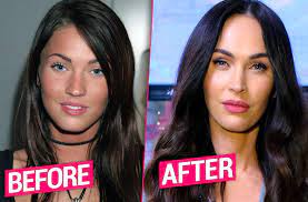 She began her acting career in 2001, with several minor television and film roles, and played a regular role on the hope & faith television sitcom. Megan Fox Plastic Surgery Transformation Revealed By Top Doctors